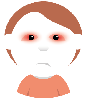 Illustration av ett barn med röda inflammerade ögon